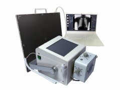 玻利维亚客户咨询DR室内使用