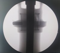 工业无损检测有什么 势
